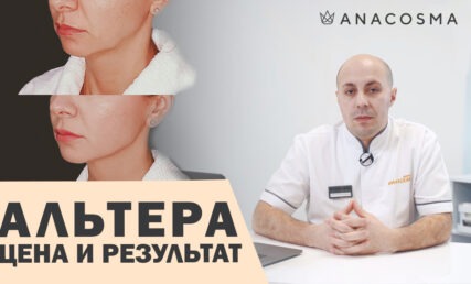 Альтера цена и результат