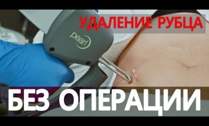 hqdefault (46)
