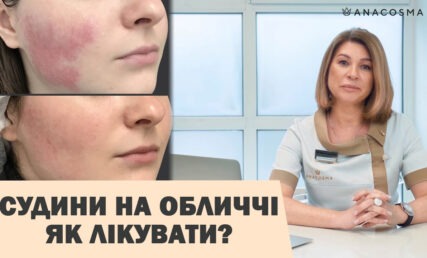 купероз