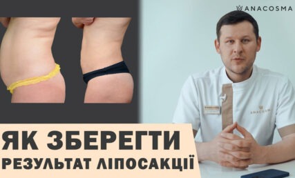 ЯК ЗБЕРЕГТИ РЕЗУЛЬТАТ ЛІПОСАКЦІЇ