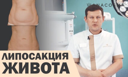 Обложка_липосакция