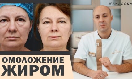 нанографтинг
