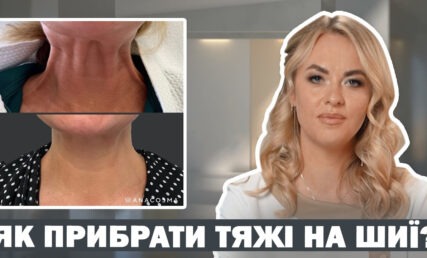 Як прибрати тяжі на шиї
