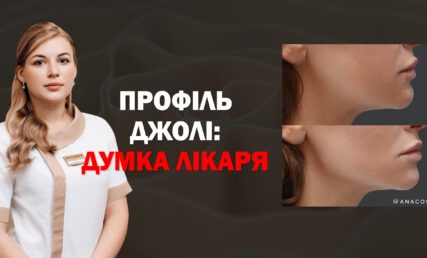skyli-kak-djoli